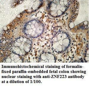 Polyclonal Rabbit anti-Human ZNF223 Antibody (aa88-358, IHC, WB)