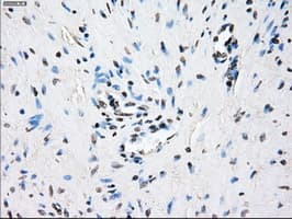 CRYAB / Alpha B Crystallin Antibody (clone OTI6G5)