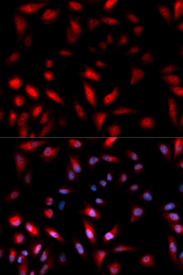Polyclonal Rabbit anti-Human HSPB1 / HSP27 Antibody (phospho-Ser82, IHC, IF, WB)
