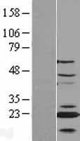 CENPN / CENP-N Protein (Over-Expression Lysate Myc-DDK (Flag))