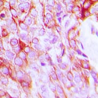 EGFR Antibody (C-Terminus)