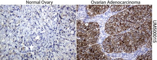 Monoclonal Mouse anti-Human CTNNB1 / Beta Catenin Antibody (clone UMAB15, Carrier-free, IHC, IF, WB)