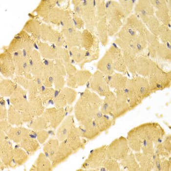 YWHAB / 14-3-3 Beta Antibody