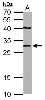 NQO1 Antibody (aa213-274)