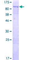 Human DIS3L2 Protein (Recombinant GST)