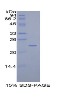 Human TLN1 / Talin 1 Protein (Recombinant His)