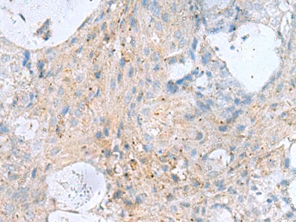 Polyclonal Rabbit anti-Human Kinesin 5A / KIF5A Antibody (IHC)