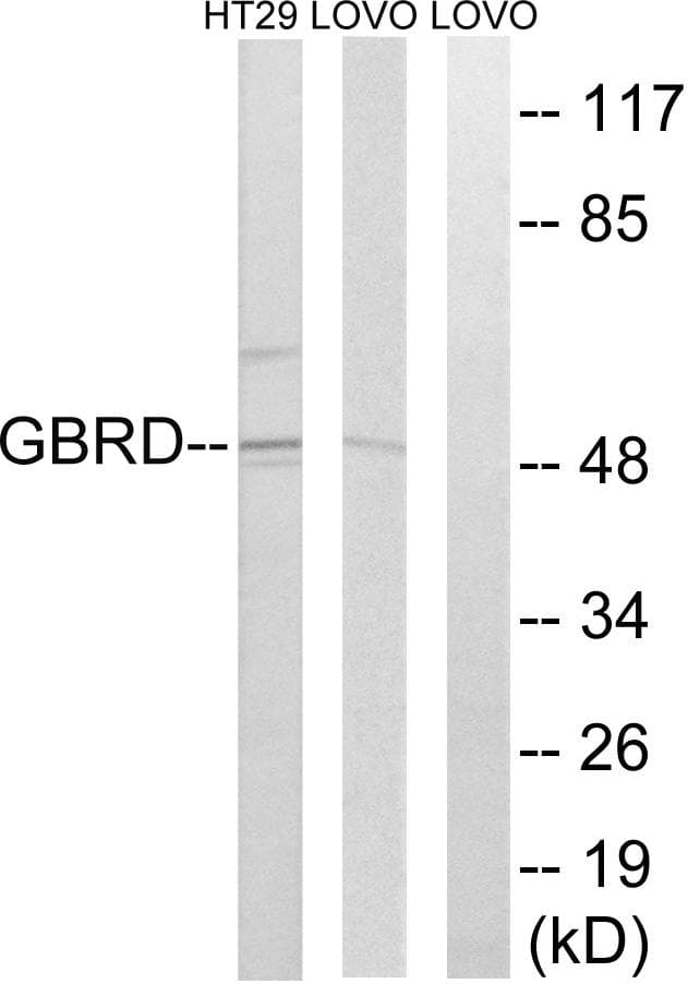 Polyclonal Rabbit anti-Human GABRD Antibody (WB)