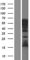 MAP6 Protein (Over-Expression Lysate Myc-DDK (Flag))