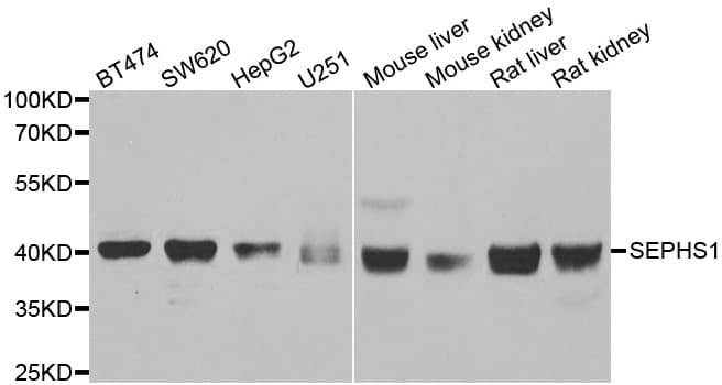 SEPHS1 / SPS Antibody
