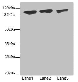 DDX20 / GEMIN3 Antibody