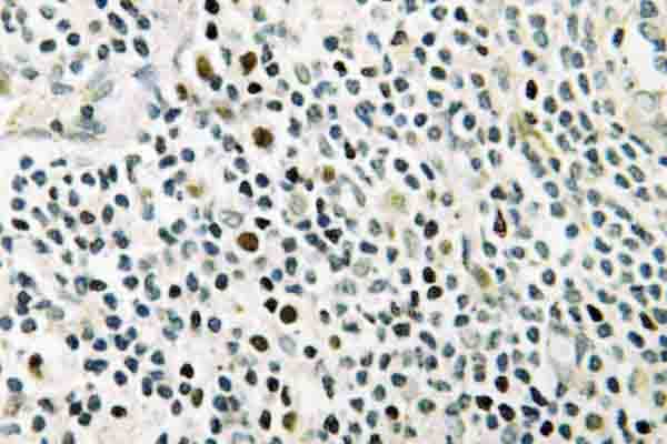 NPM1 / NPM / Nucleophosmin Antibody (Lys230)