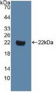 DVL1 / DVL / Dishevelled Antibody (aa150-285)