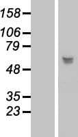 LRRC17 Protein (Over-Expression Lysate Myc-DDK (Flag))