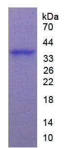 Human ARG1 / Arginase 1 Protein (Recombinant His, N-Terminal)
