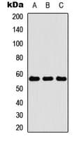 KRT4 / CK4 / Cytokeratin 4 Antibody (Internal)