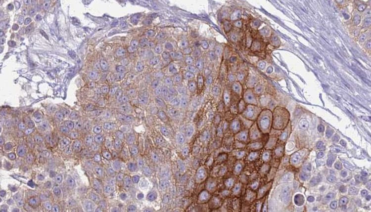 SUR2 / ABCC9 Antibody