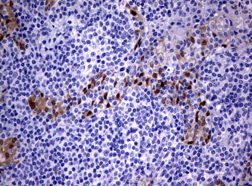 IRF6 Antibody (clone UMAB106, Carrier-free)