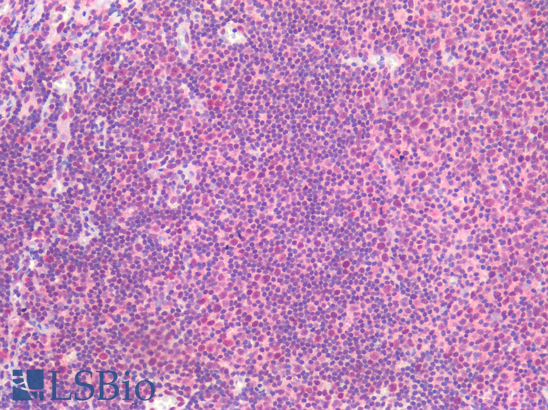 PathPlus™ Monoclonal Mouse anti-Human FOXP1 Antibody (clone JC12, IHC, WB)