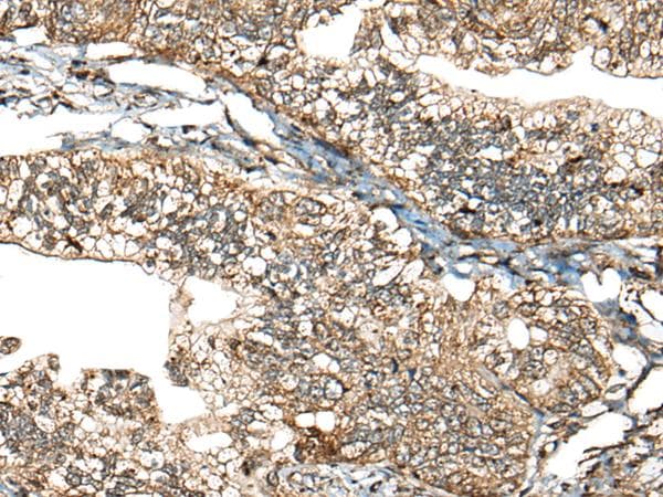 Polyclonal Rabbit anti-Human CALHM1 Antibody (IHC)