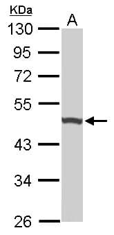 UQCRC1 Antibody (aa1-206)
