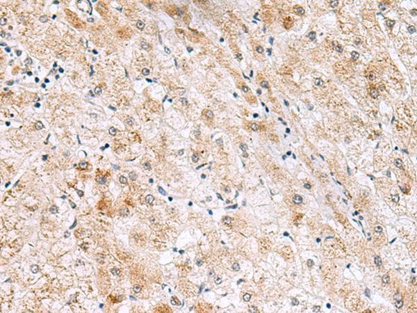 GPC2 / Glypican 2 Antibody