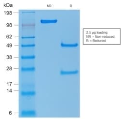 PathPlus™ TP53 / p53 Antibody (clone rTP53/1739)