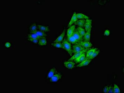 IHC-plus™ FDFT1 / Squalene Synthase Antibody