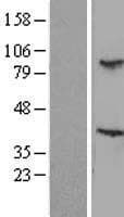 TBL3 Protein (Over-Expression Lysate Myc-DDK (Flag))