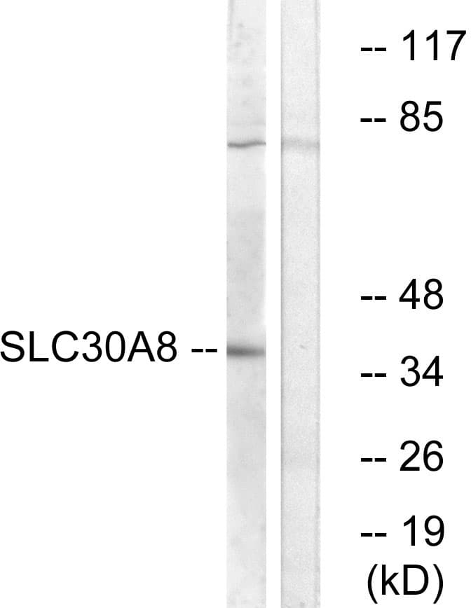 Polyclonal Rabbit anti-Human SLC30A8 / ZNT8 Antibody (aa171-220, WB)