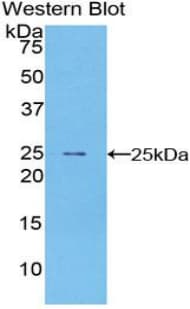 PMP22 Antibody (aa1-160)