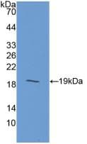 Gastric Inhibitory Peptide Antibody (aa22-153)