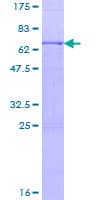 Human ACTRIIB / ACVR2B Protein (Recombinant GST)