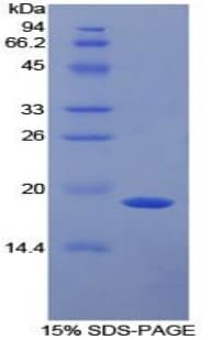 Mouse SERPINF2 / Alpha-2-Antiplasmin Protein (Recombinant His)