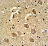 Polyclonal Rabbit anti-Human CASP3 / Caspase 3 Antibody (aa149-179, IHC, WB)