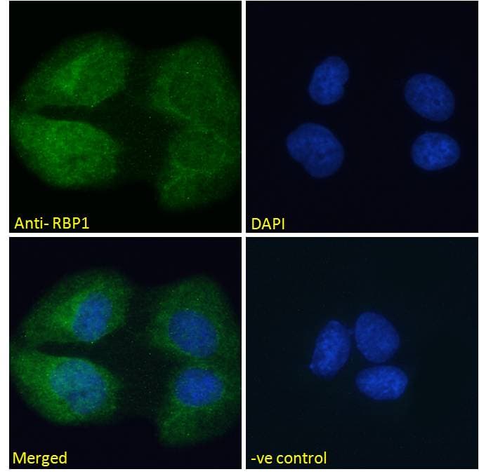IHC-plus™ RBP1 / CRBP Antibody (aa122-135)