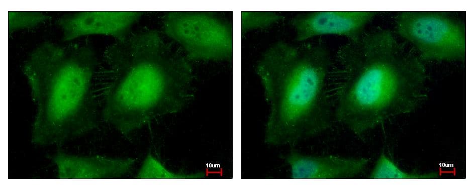 EIF3K Antibody (aa1-173)