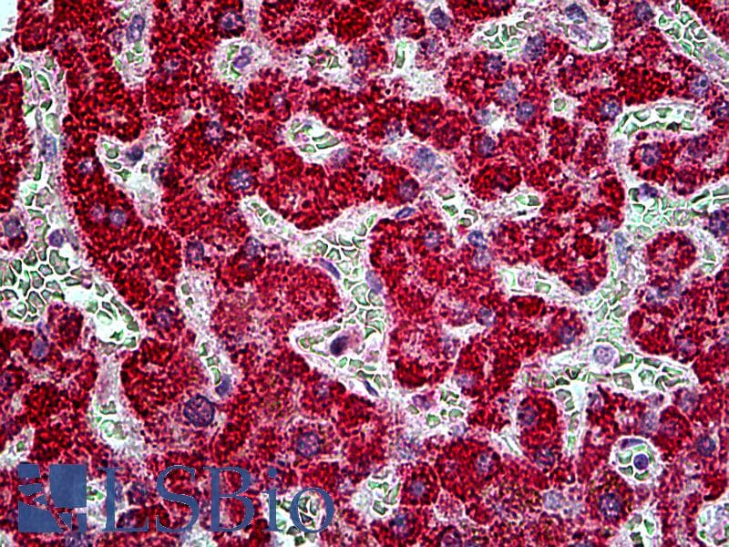 IHC-plus™ TBC1D10A Antibody (aa2-14)
