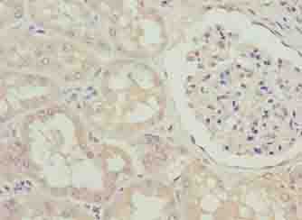 Polyclonal Rabbit anti-Human SPACA1 Antibody (IHC)