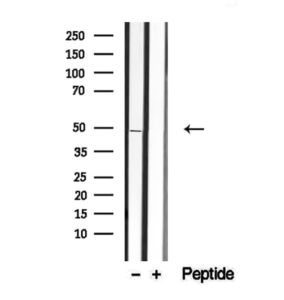 INHBA / Inhibin Beta A Antibody