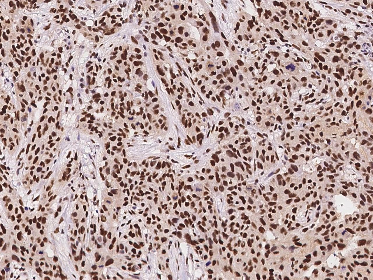 Polyclonal Rabbit anti-Human HSF1 Antibody (Preservative Free, IHC)