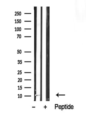 Polyclonal Rabbit anti-Human PDE6G / PDE6 Gamma Antibody (WB)