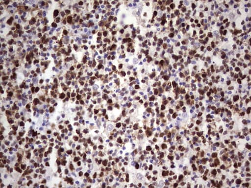 Monoclonal Mouse anti-Human MCM2 Antibody (clone OTI3C12, IHC, WB)