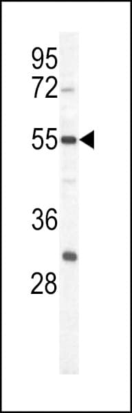 IHC-plus™ PKM / Pyruvate Kinase, Muscle Antibody (aa383-417)