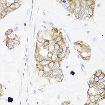 IER3 / IEX-1 Antibody