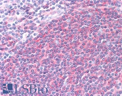 IHC-plus™ SNX8 Antibody (clone 4F8)