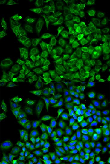 Polyclonal Rabbit anti-Human ALDOA / Aldolase A Antibody (IHC, IF, WB)
