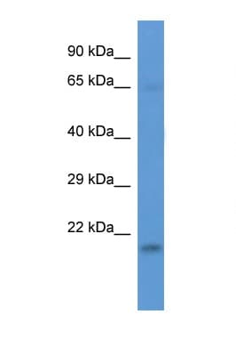NAA38 / LSMD1 Antibody (aa60-109)