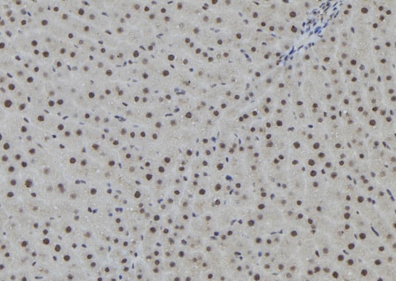 AGO2 / EIF2C2 Antibody