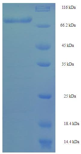 Human WDR21A / DCAF4 Protein (Recombinant His-SUMO)
